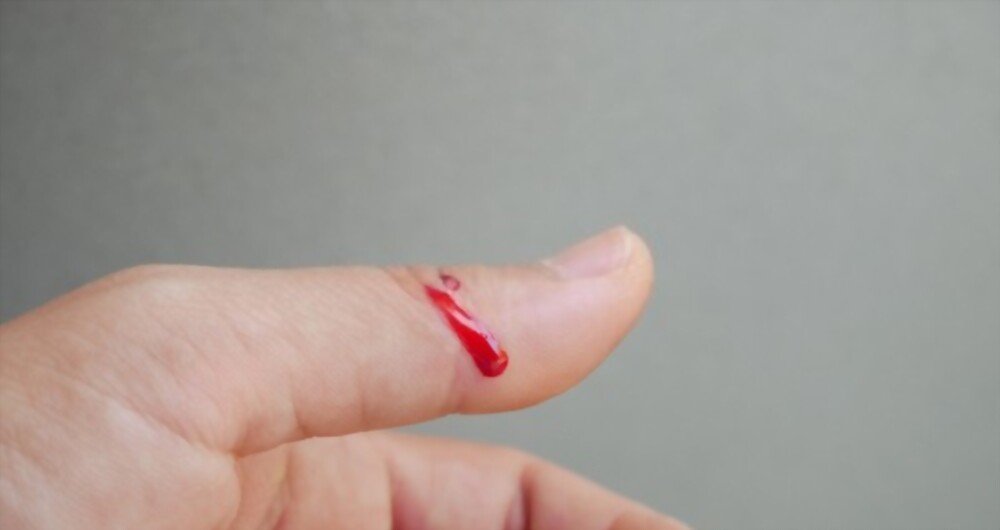 Fresh wound with blood in finger on blur background.